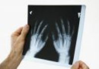 Handchirurgie