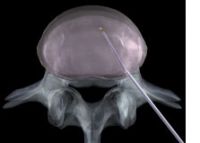 08 - Therapie-operativ